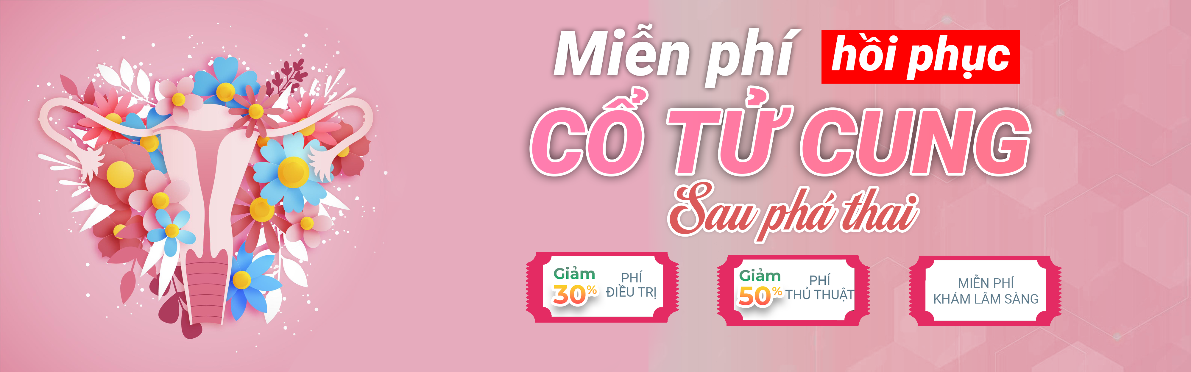 Banner ưu đãi 1