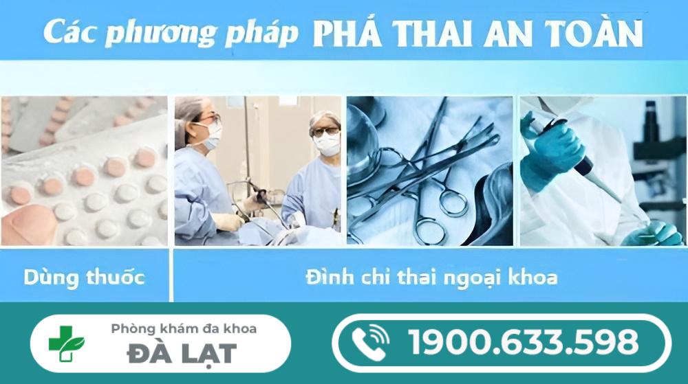 Hình ảnh minh họa