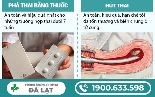 Hình ảnh minh họa