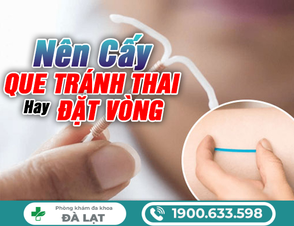 Hình ảnh minh họa