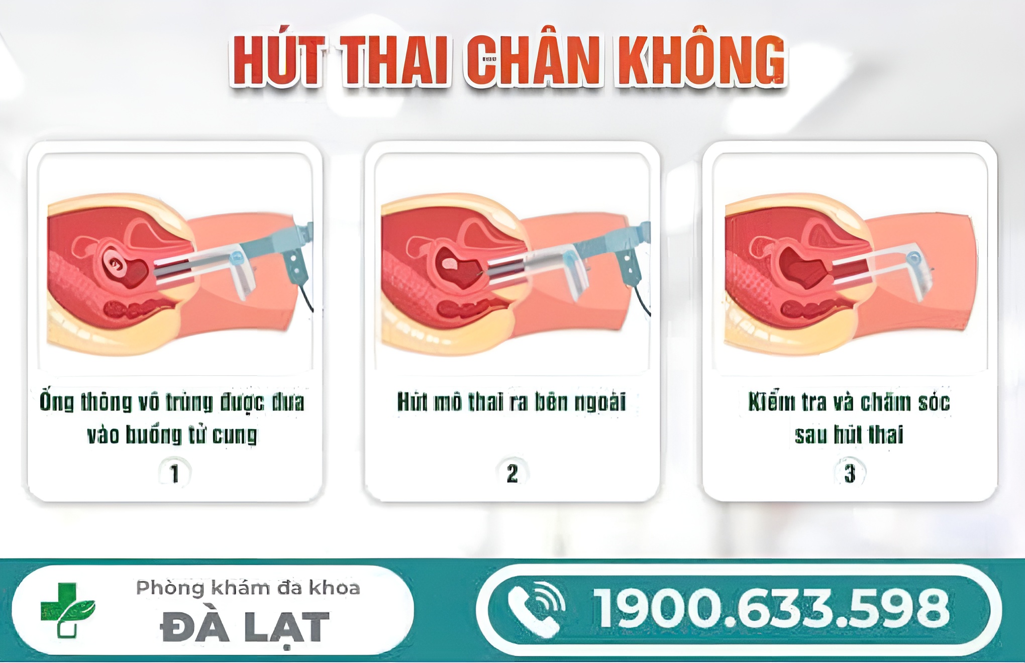 Hình ảnh minh họa